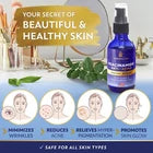 Forceup Niacinamide Serum in a glass dropper bottle with a clear serum against a white background.